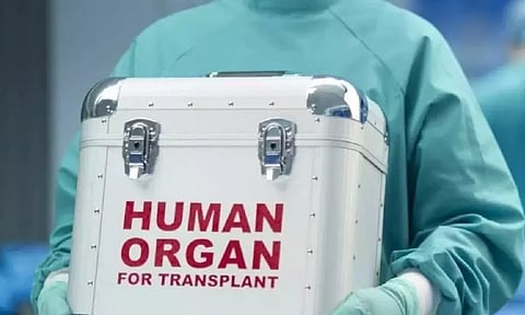 Representative Image