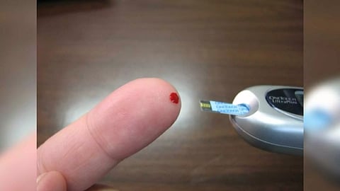 Representative Image (Photo/IANS)