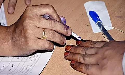 Representative image.