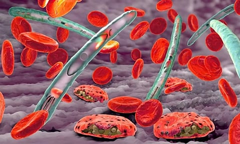 Representative image