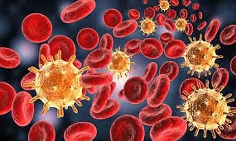 Representative image