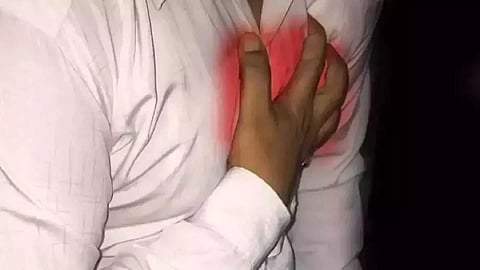 Representative Image