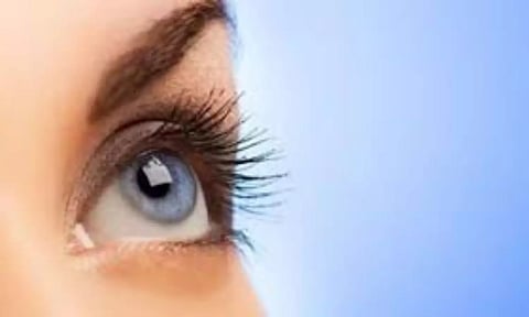 Representative Image