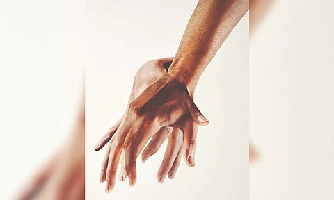 Representative image.