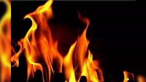 Representative Image