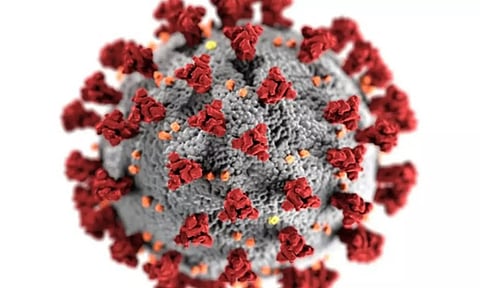 Representative Image