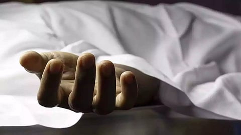 Representative Image