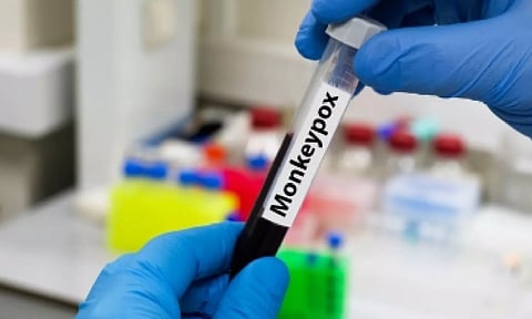 Representative Image (IANS)