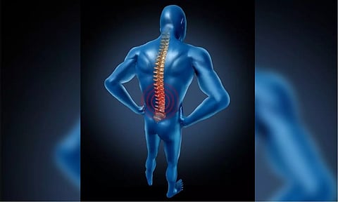 Representative image