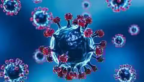 Representative Image