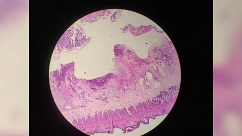 Representative Image (Photo/IANS)