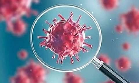 Representative image