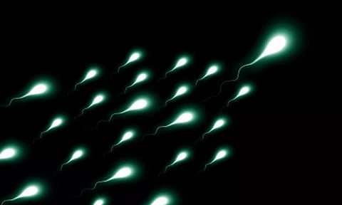 Representative image