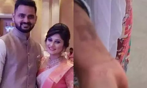 Anto Mathivanan and Marlina; Injuries on 18-year-old victim. (Maalaimalar)