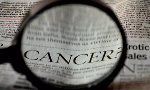 Representative Image