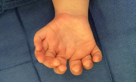 Representative image