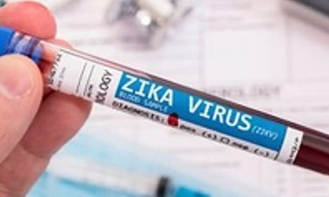 Representative image