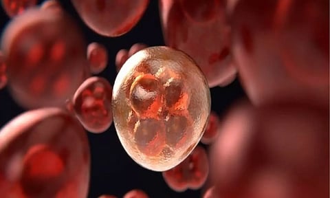 Representative Image (ANI)