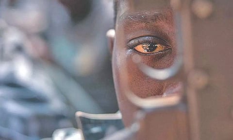 Representative image