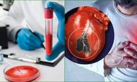 Representative Image (IANS)