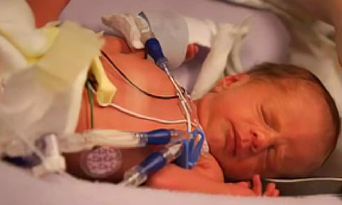 Representative image