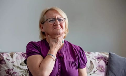 Representative image