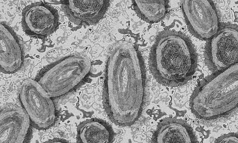 Representative image. (Pixabay)