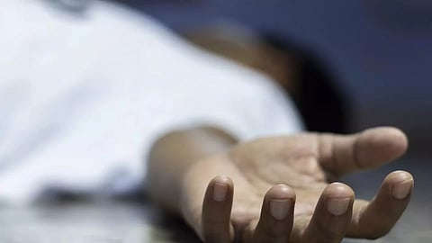 Representative Image