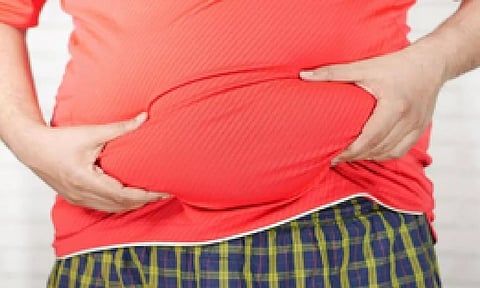 Representative image