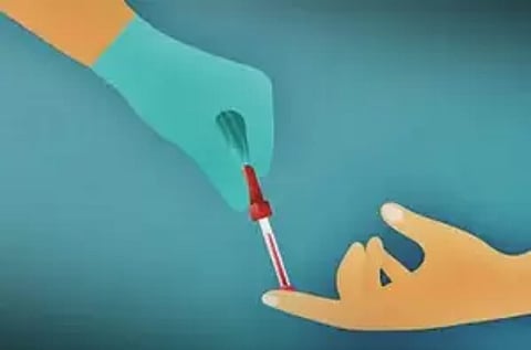 Representative image