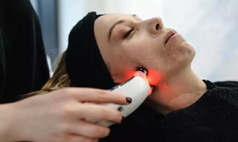 Representative image