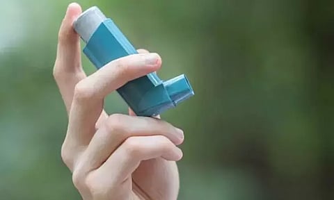 Representative image