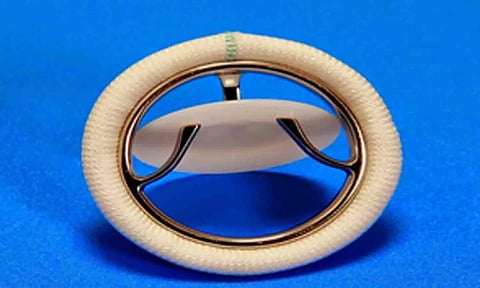 Representative Image (IANS)