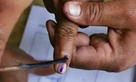 Representative Image