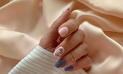 Representative image