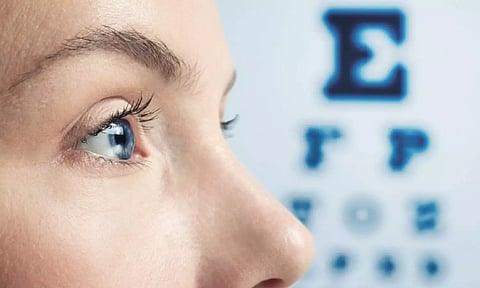 Representative Image