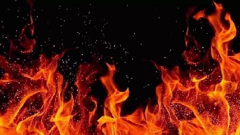 Representative Image