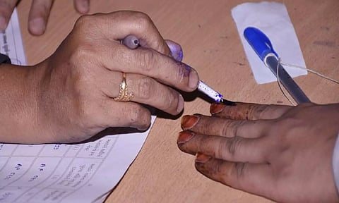 Representative Image