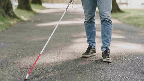 Representative Image