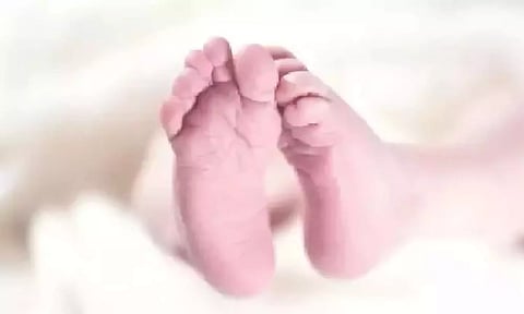 Representative Image