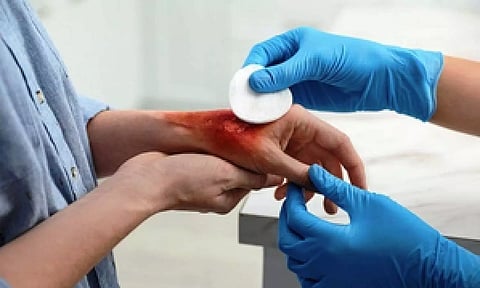 Representative Image (IANS)