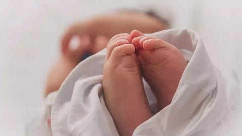 Representative Image