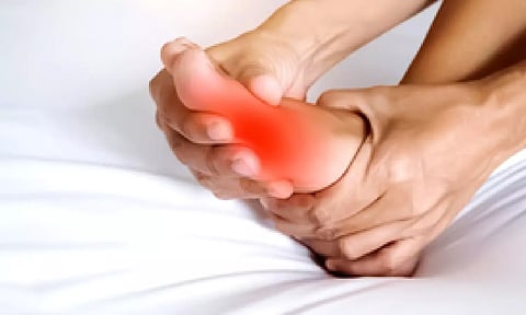 Representative image