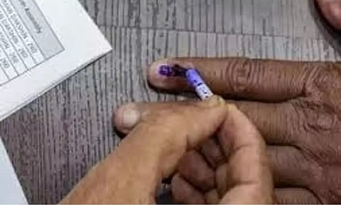 Representative Image