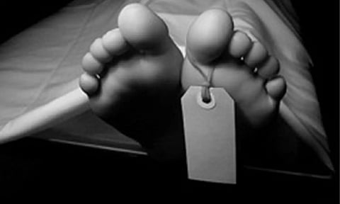 Representative Image