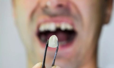 Representative Image