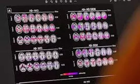 Representative image (Photo/Reuters)