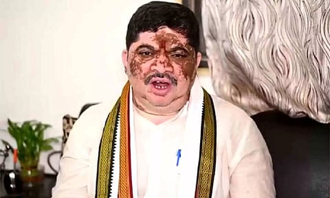 Telangana Minister Ponnam Prabhakar 