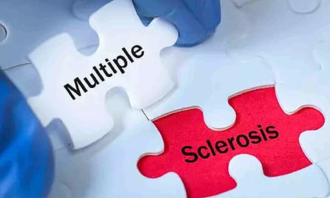 Young, women more likely to suffer from multiple sclerosis: Experts