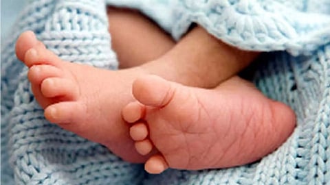 Representative Image